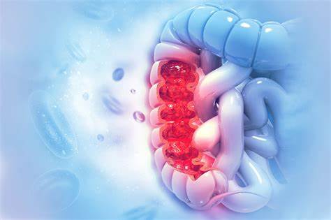 Colorectal Cancer Treatment in Dwarka